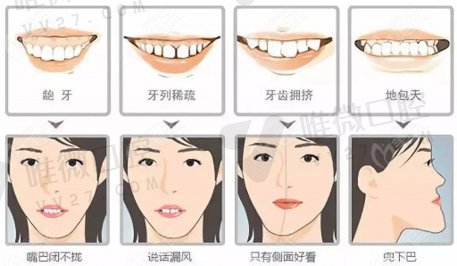 假牙和全口义齿区别图示,假牙和真牙的区别(图1)